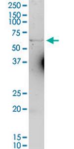 SLC40A1 Antibody in Western Blot (WB)