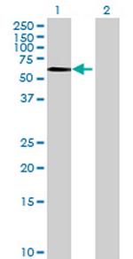 SOX8 Antibody in Western Blot (WB)