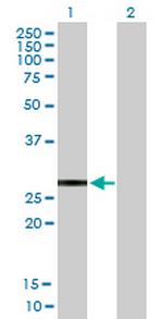 KCNIP2 Antibody in Western Blot (WB)