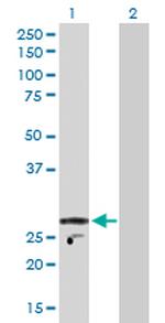 KCNIP2 Antibody in Western Blot (WB)