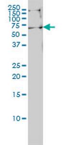 EHD4 Antibody in Western Blot (WB)