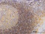 PIK3R4 Antibody in Immunohistochemistry (Paraffin) (IHC (P))