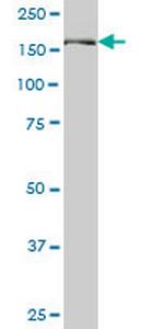 PIK3R4 Antibody in Western Blot (WB)