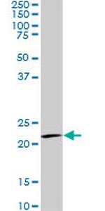 IL20 Antibody in Western Blot (WB)