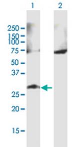 GALNT9 Antibody in Western Blot (WB)
