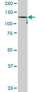 DDEF1 Antibody in Western Blot (WB)