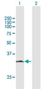 HDGFRP3 Antibody in Western Blot (WB)