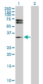 HDGFRP3 Antibody in Western Blot (WB)