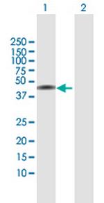 NSDHL Antibody in Western Blot (WB)