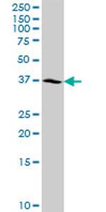 NSDHL Antibody in Western Blot (WB)