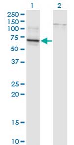 TBX22 Antibody in Western Blot (WB)