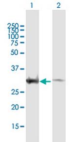 EXOSC3 Antibody in Western Blot (WB)