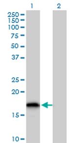 GLRX2 Antibody in Western Blot (WB)