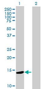 ZNF593 Antibody in Western Blot (WB)