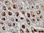 ABHD5 Antibody in Immunohistochemistry (Paraffin) (IHC (P))