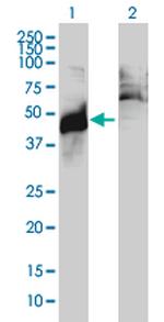 ABHD5 Antibody in Western Blot (WB)