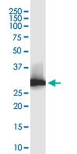 LACTB2 Antibody in Western Blot (WB)