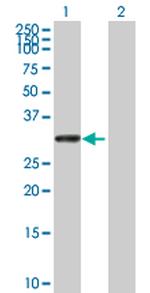 UTP11L Antibody in Western Blot (WB)