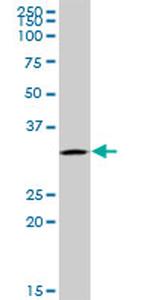 UTP11L Antibody in Western Blot (WB)