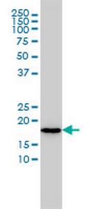 NAT5 Antibody in Western Blot (WB)