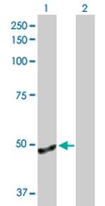 ANGPTL4 Antibody in Western Blot (WB)