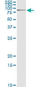 RNF12 Antibody in Immunoprecipitation (IP)