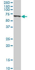 SLC45A2 Antibody in Western Blot (WB)