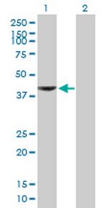 AADAT Antibody in Western Blot (WB)