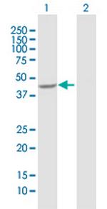 AADAT Antibody in Western Blot (WB)