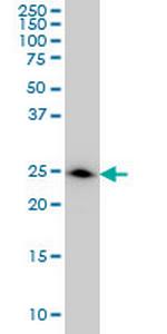 DCXR Antibody in Western Blot (WB)