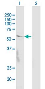 CRBN Antibody in Western Blot (WB)