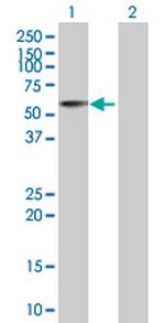 ACP6 Antibody in Western Blot (WB)