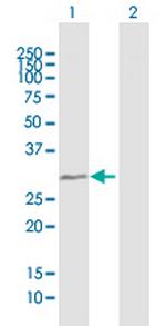 TBC1D7 Antibody in Western Blot (WB)