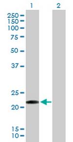 CLEC1B Antibody in Western Blot (WB)