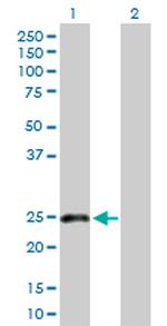 CLEC1B Antibody in Western Blot (WB)