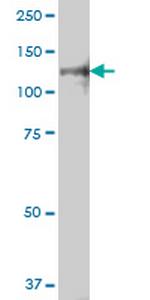 TLR7 Antibody in Western Blot (WB)