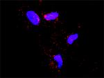 ECSIT Antibody in Proximity Ligation Assay (PLA) (PLA)