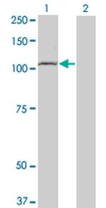 TLR8 Antibody in Western Blot (WB)