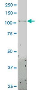 TLR8 Antibody in Western Blot (WB)