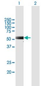 RKHD2 Antibody in Western Blot (WB)