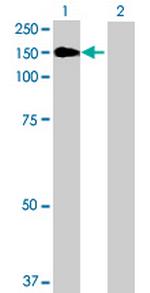 TAOK3 Antibody in Western Blot (WB)