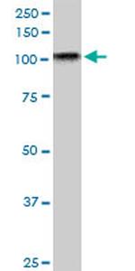 TAOK3 Antibody in Western Blot (WB)