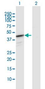 HEMK1 Antibody in Western Blot (WB)