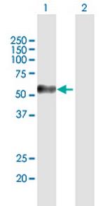 MAGEC2 Antibody in Western Blot (WB)