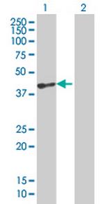 VGLL1 Antibody in Western Blot (WB)