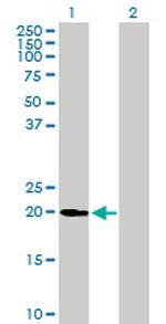 UFC1 Antibody in Western Blot (WB)