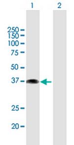 ETV7 Antibody in Western Blot (WB)