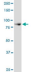 NCKIPSD Antibody in Western Blot (WB)