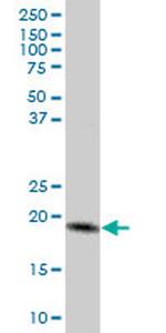 MTP18 Antibody in Western Blot (WB)