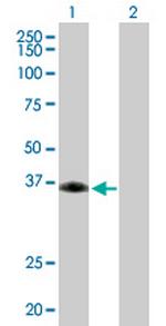 SIRT6 Antibody in Western Blot (WB)